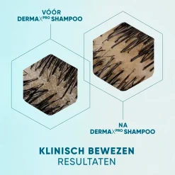 DermaXPro by Head & Shoulders Revitaliseert Antiroosshampoo