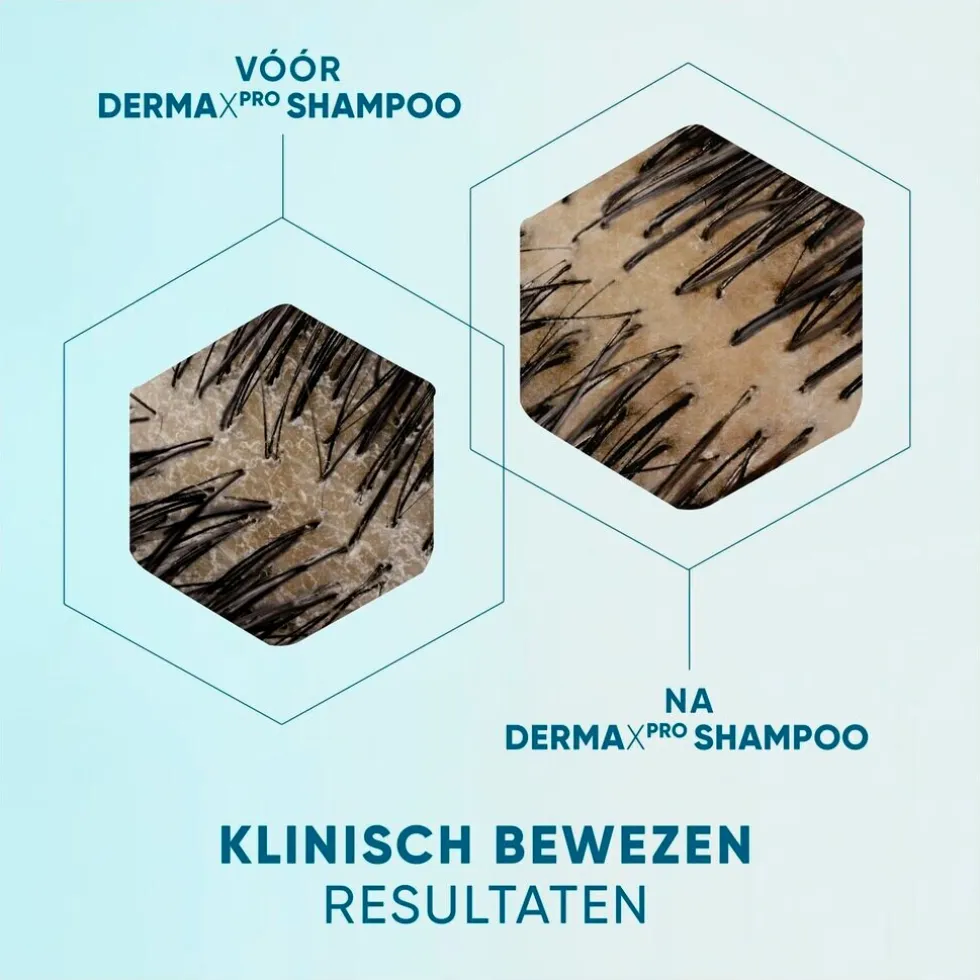 DermaXPro by Head & Shoulders Revitaliseert Antiroosshampoo