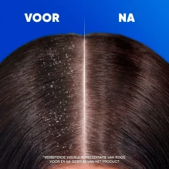 Head & Shoulders Anti-Haaruitval Antiroosshampoo