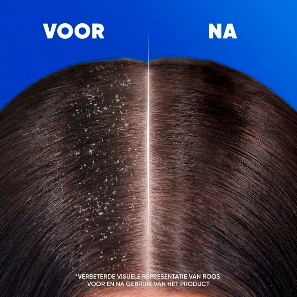 Head & Shoulders Apple Fresh 2-in-1 Antiroosshampoo