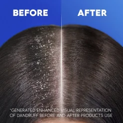 Head & Shoulders Classic Clean 2-in-1 Shampoo met Pomp