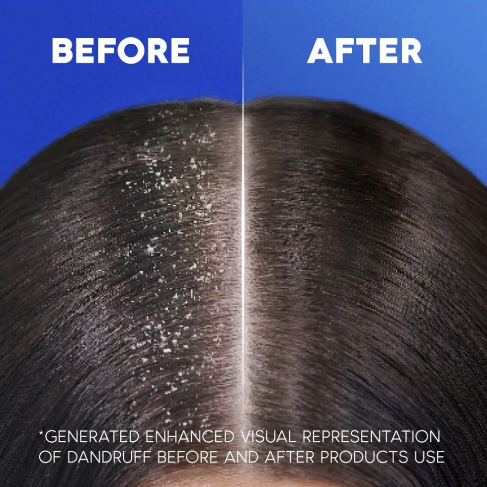 Head & Shoulders Classic Clean 2-in-1 Shampoo met Pomp
