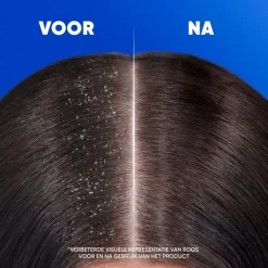 Head & Shoulders Classic 2-in-1 Antiroosshampoo