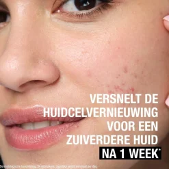 Neutrogena Anti-Puistjes+ 7% AHA + Panthenol Vloeibare Exfoliant