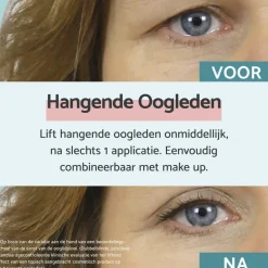 Remescar Hangende Oogleden Oogcrème