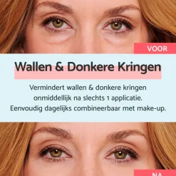Remescar Wallen & Donkere Kringen Crème